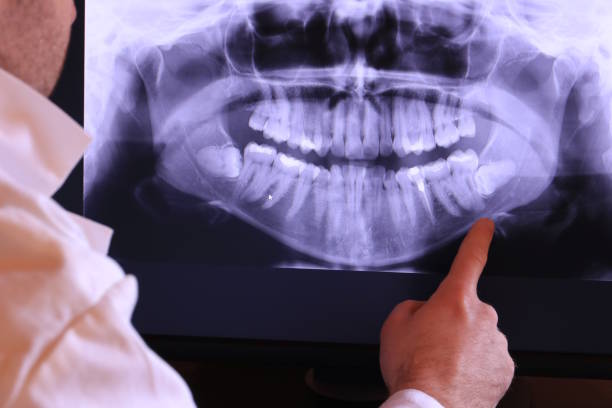 Best Root Canal Emergency Dentist  in Middletown, OH
